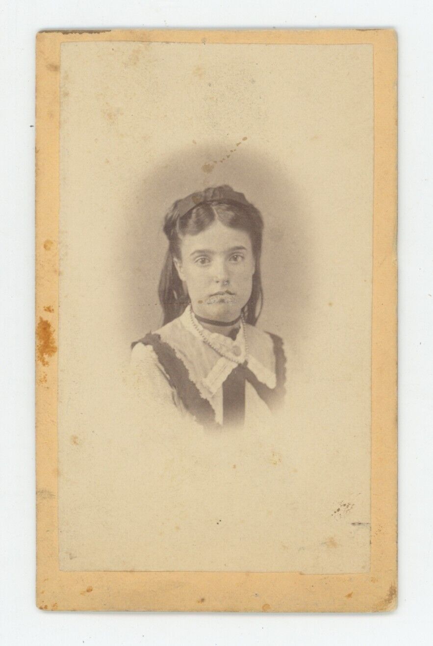 Antique CDV Circa 1870s 15 yr Old Beautiful Girl Wearing Black Thin Choker