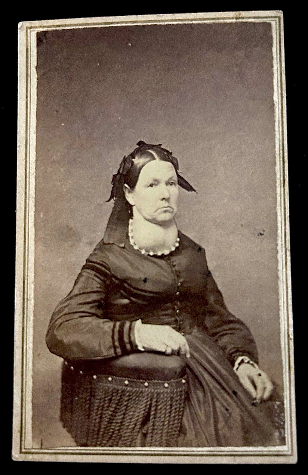 Rare 19th C CDV Violet Hayes Brown – Medical Curiosity – Possible Severe Goiter