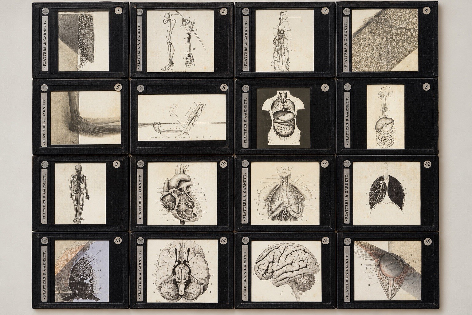 Antique Medical Anatomy Magic Lantern Slides Flatters & Garnett
