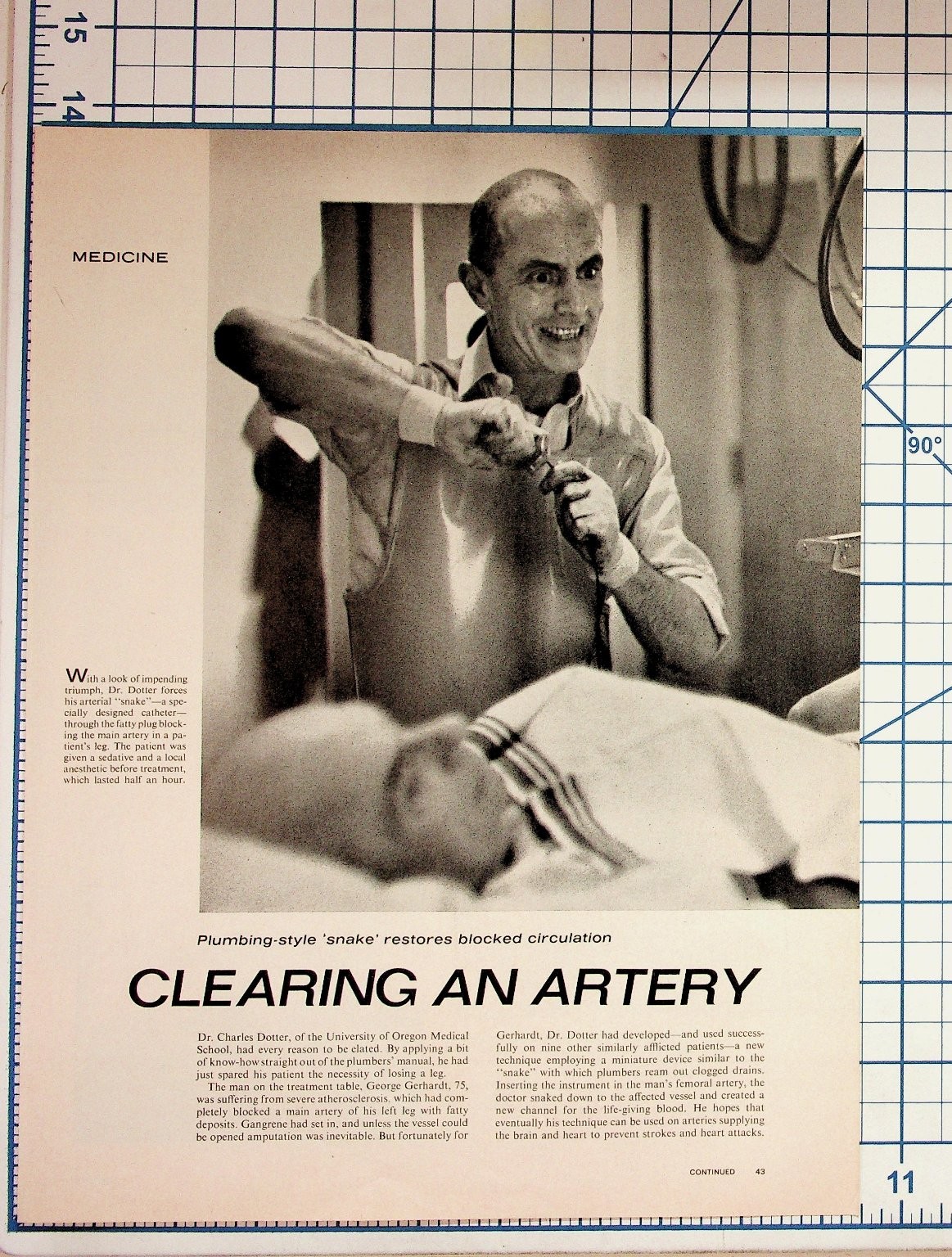 1960s Dr. Charles Dotter Artery Clearing Surgery Meds Tampon Magazine Article