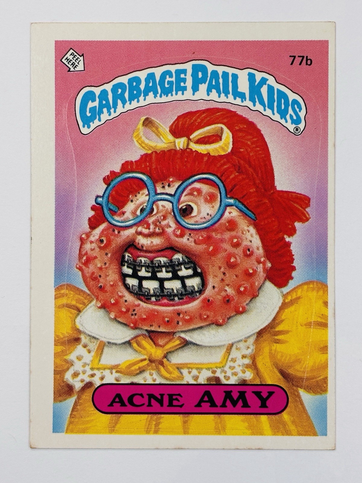 1985 Topps Garbage Pail Kids -Series 2 -Matte #77b ACNE AMY (VG) See PICS