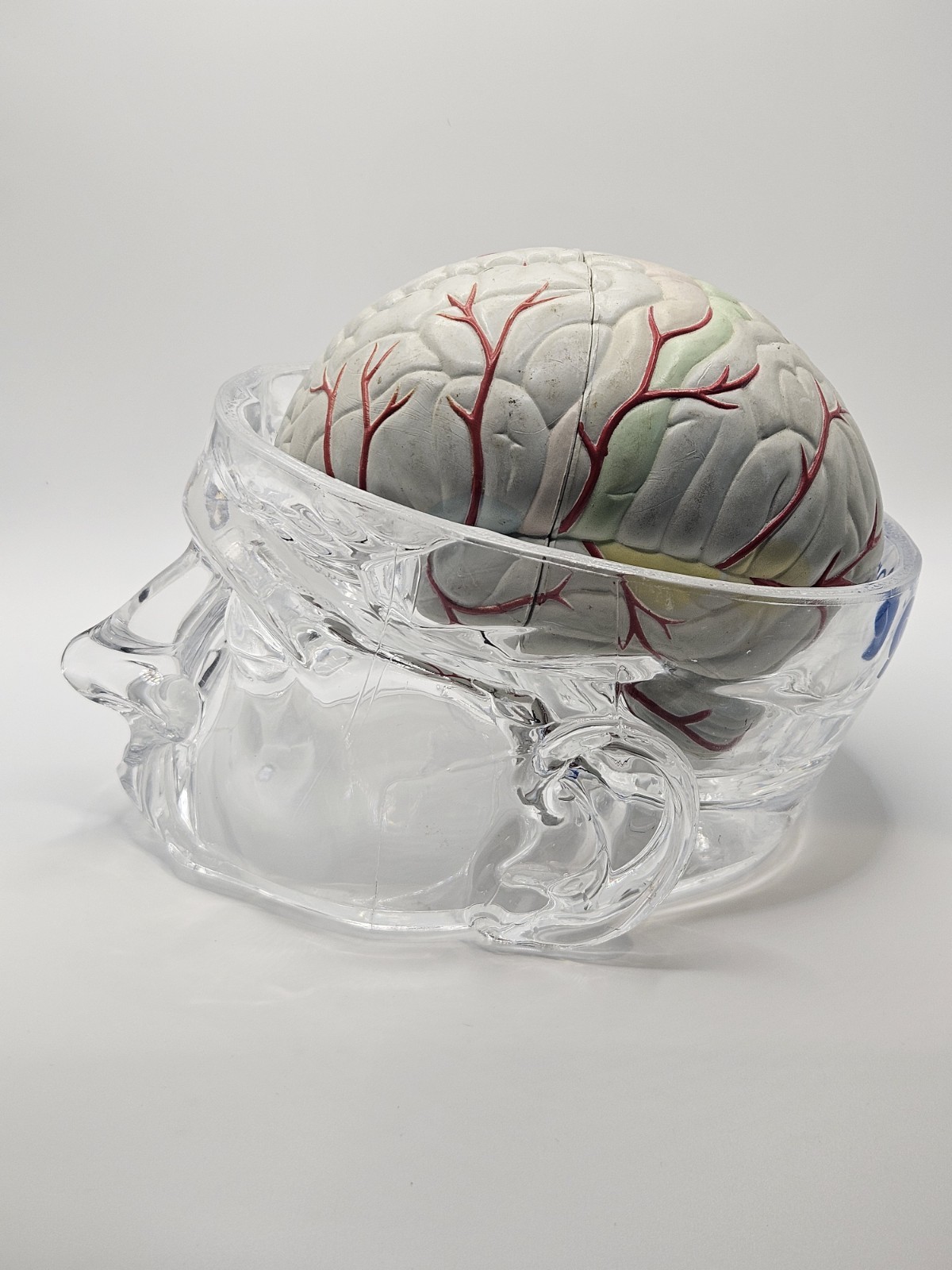 Vintage Seroquel Pharma Promo Lucite Clear Glass Head Brain Anatomical Model