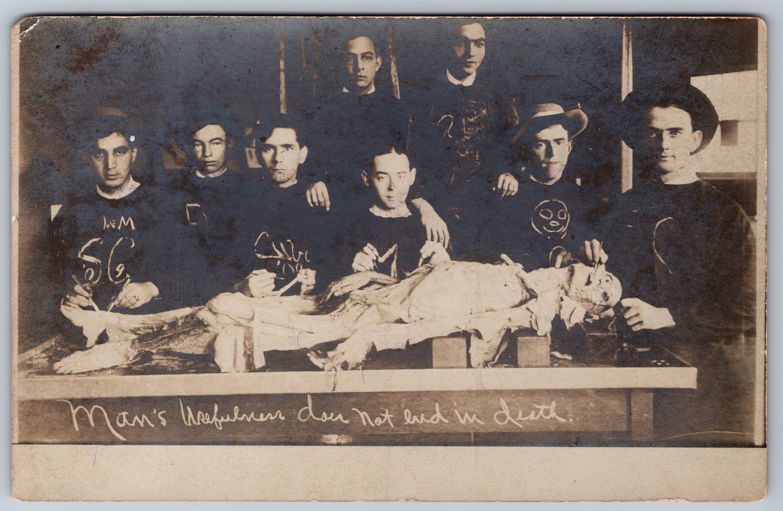 RPPC Medical Students Cadaver Dissection Memento Mori Anatomy Postcard c1905