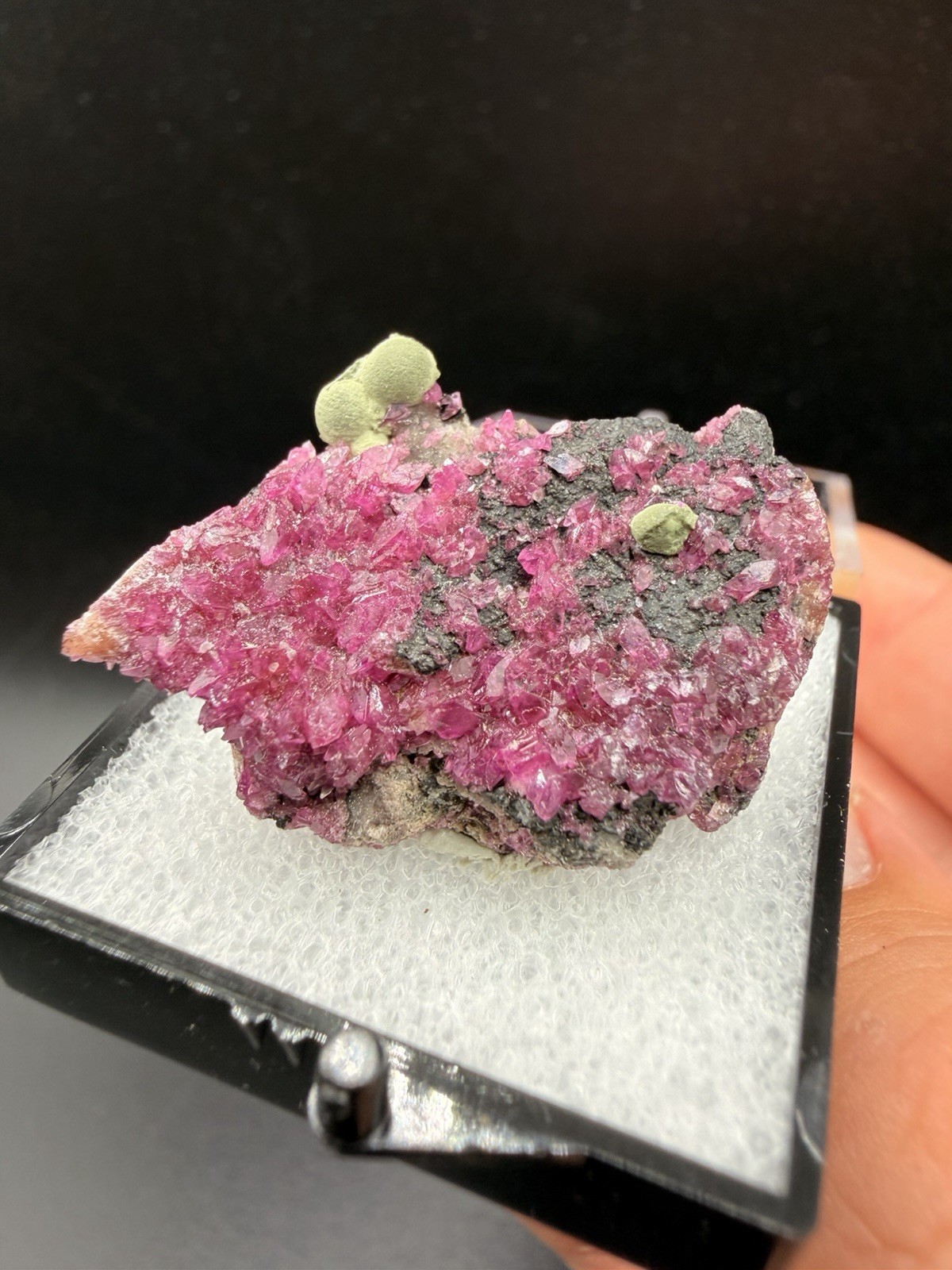 Rare Kolwezite Nodules on Hot Pink Cobalto Dolomite (Thumbnail) - Lualaba, DRC