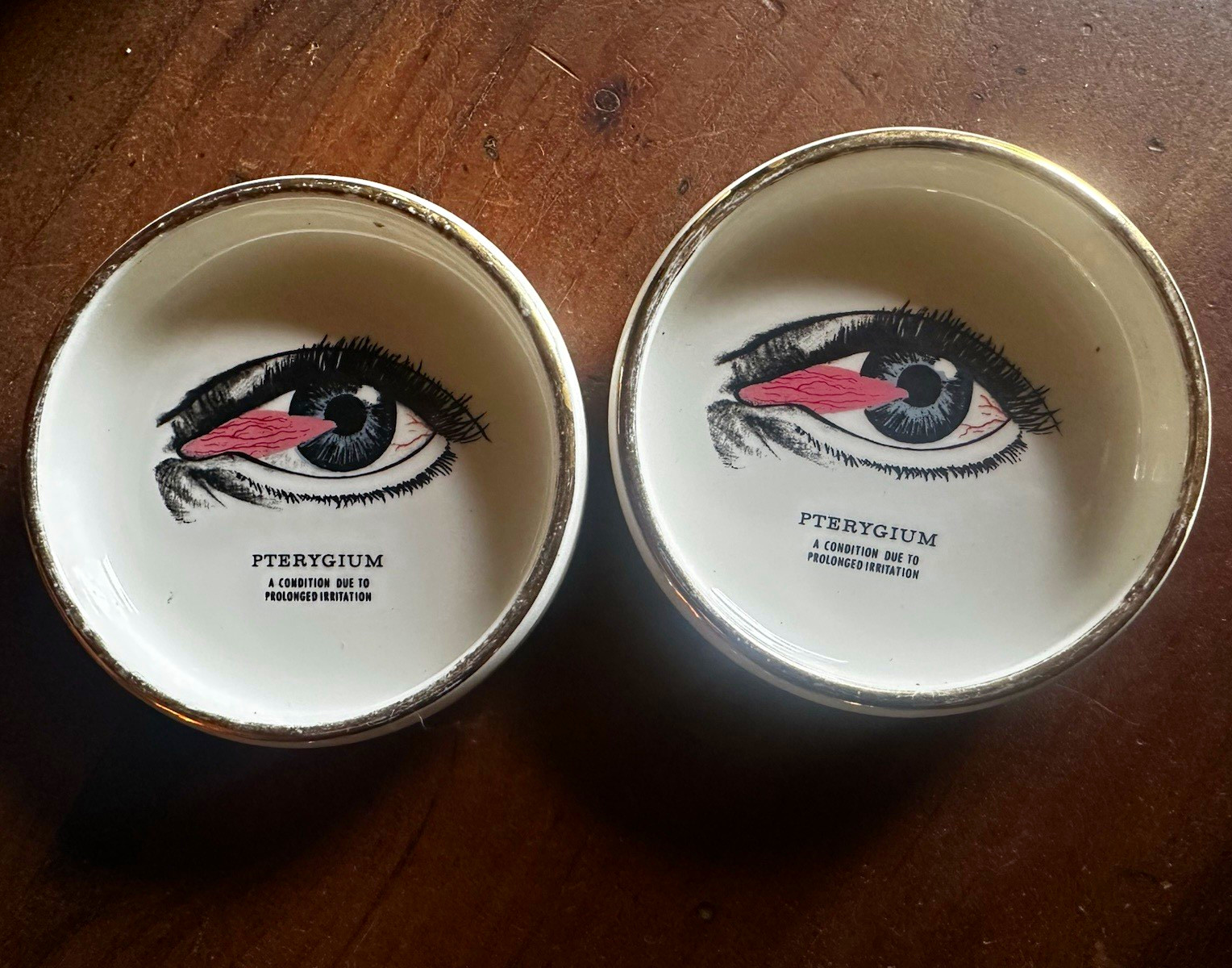 Pair Vintage Robertson Optical Labs Ceramic Eye Dishes - Pterygium Medical Art