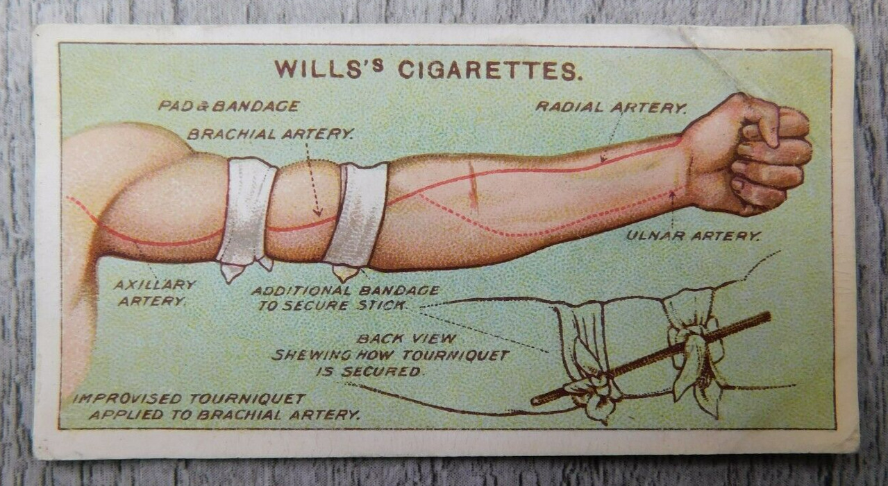 Wills\'s First Aid Cigarettes Tobacco Trade Card Vintage No. 11 Tourniquet