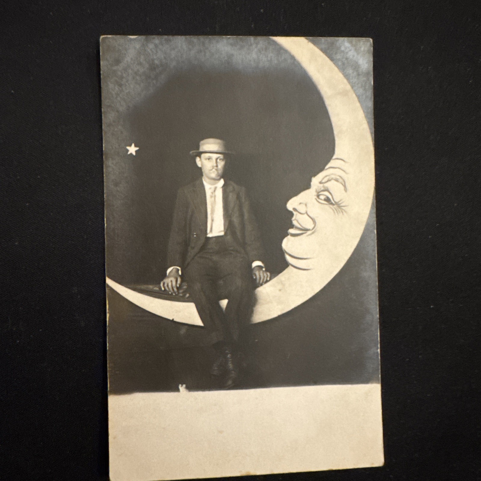 Rare C 1910 Studio Moon RPPC Handsome Man Cleft Lip Medical Condition Mouth 