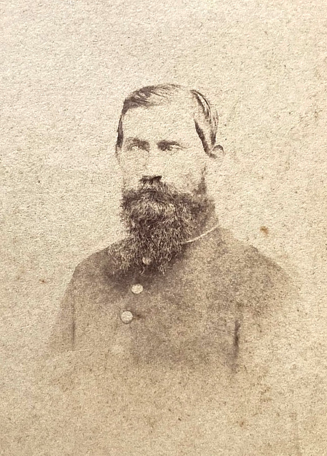 RARE CIVIL WAR CONFEDERATE WAR-BLINDED SOLDIER MEMPHIS TENN. 1862 CDV PHOTO