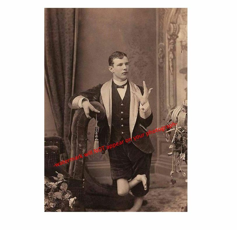Vintage Creepy Lobster Boy PHOTO Scary Sideshow Circus Freak Boy Vintage Creepy Lobster Boy PHOTO Scary Sideshow Circus Freak Boy