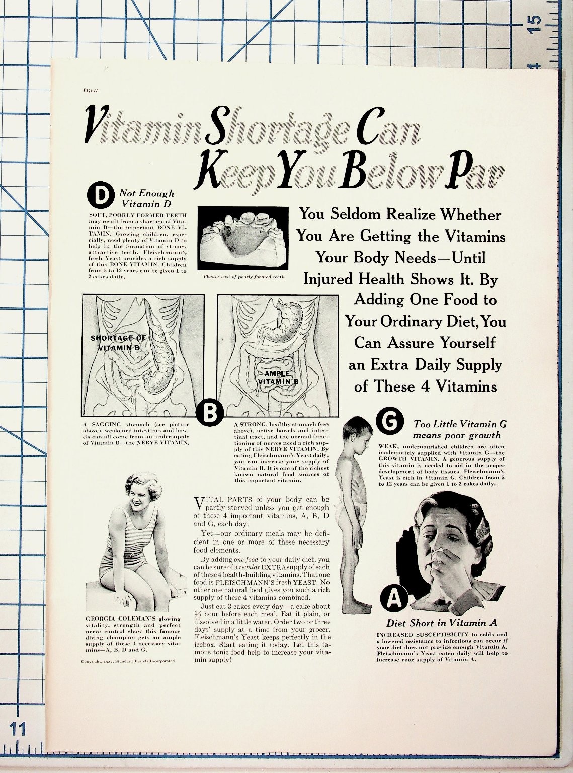 1937 Fleischmann's Yeast Vitamin Ad Georgia Coleman Health Magazine Page 1937 Fleischmann's Yeast Vitamin Ad Georgia Coleman Health Magazine Page
