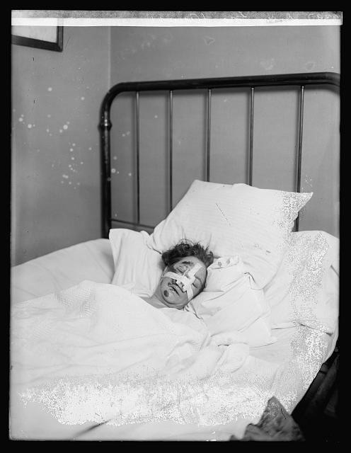 Photo:Dorsey Geo Aunt 1919 1920 bandaged patient in bed hospital photo