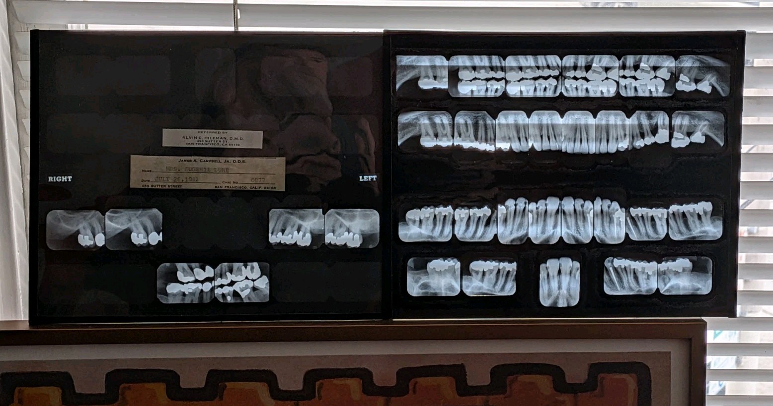 7 VinTagE Dental X-RAY Film Sheets Oddities Curiosities Teeth