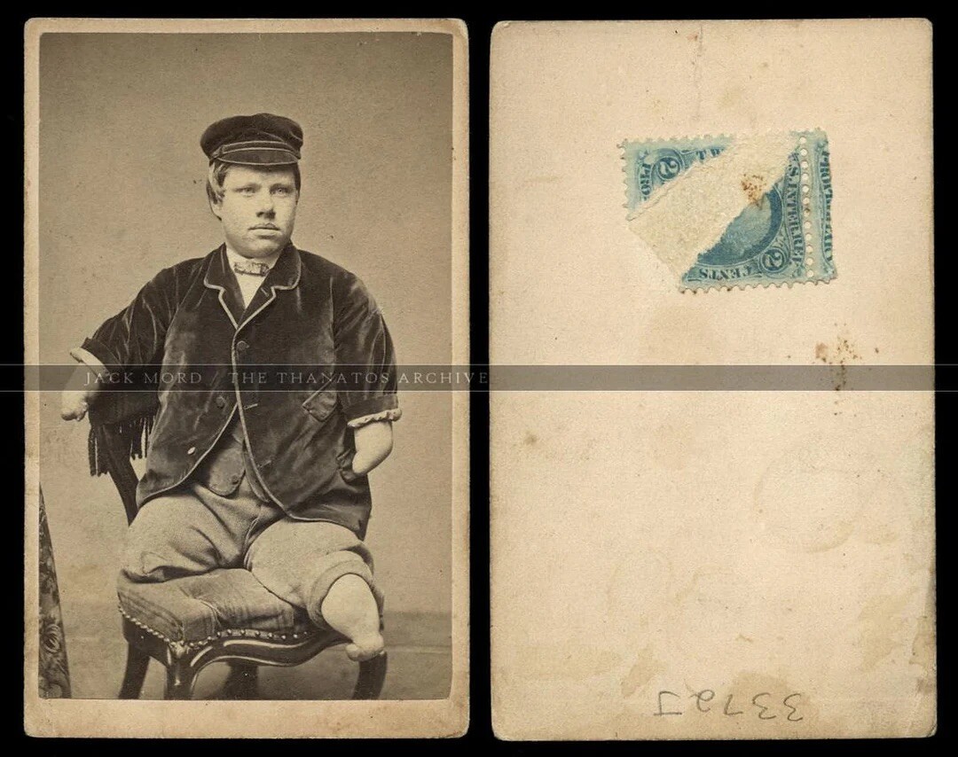 Texas Jack Sideshow Boy Very Rare Or One Of A Kind CDV Photo 1860s Tax Stamp Texas Jack Sideshow Boy Very Rare Or One Of A Kind CDV Photo 1860s Tax Stamp