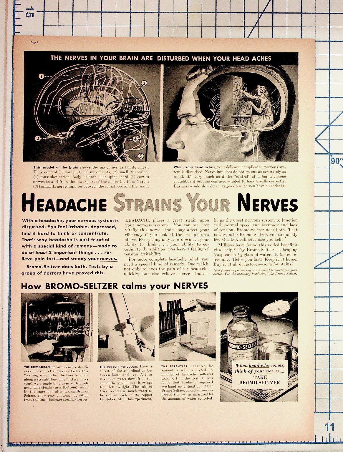 Vintage Bromo-Seltzer Print Ad 1930s Medical Brain Illustration Quack Medicine