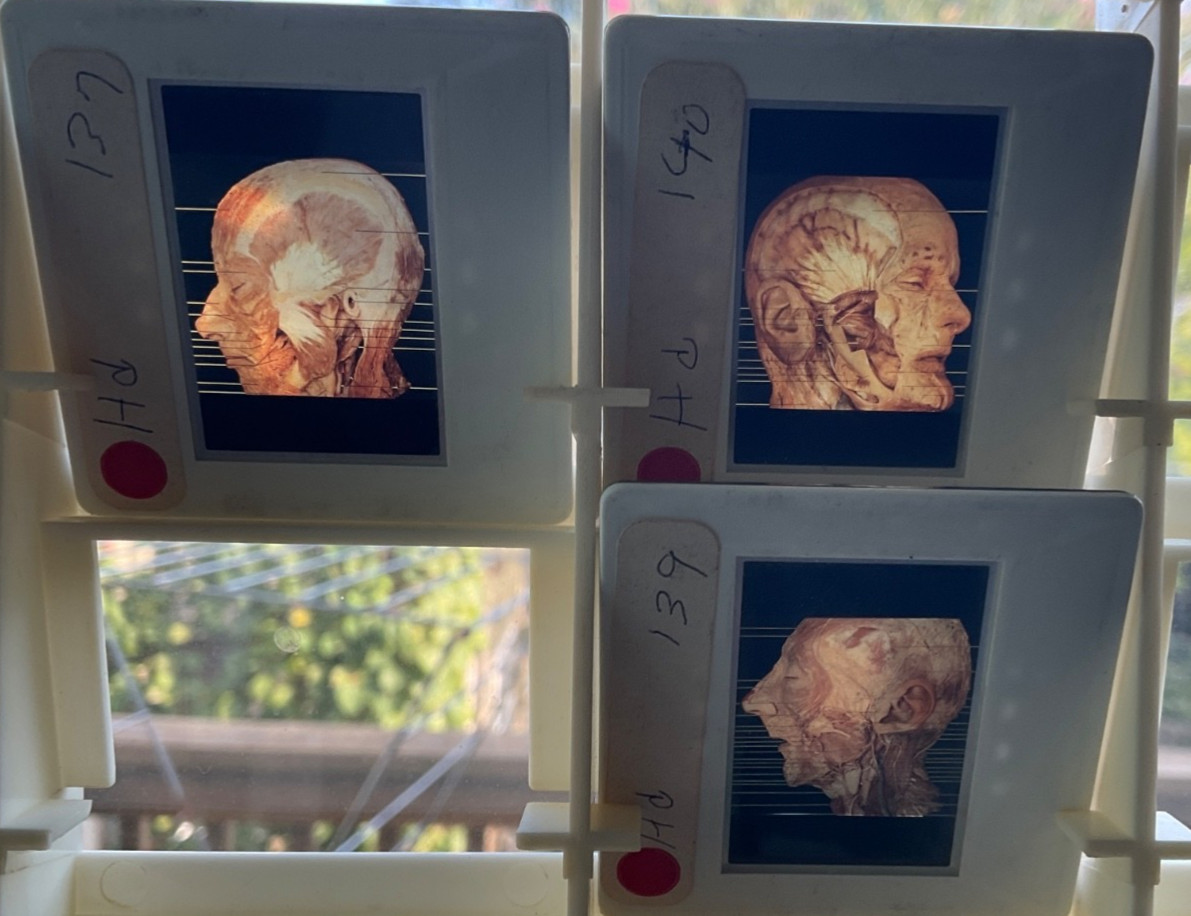 3 Glass  Slides    Human Heads medical Illustration