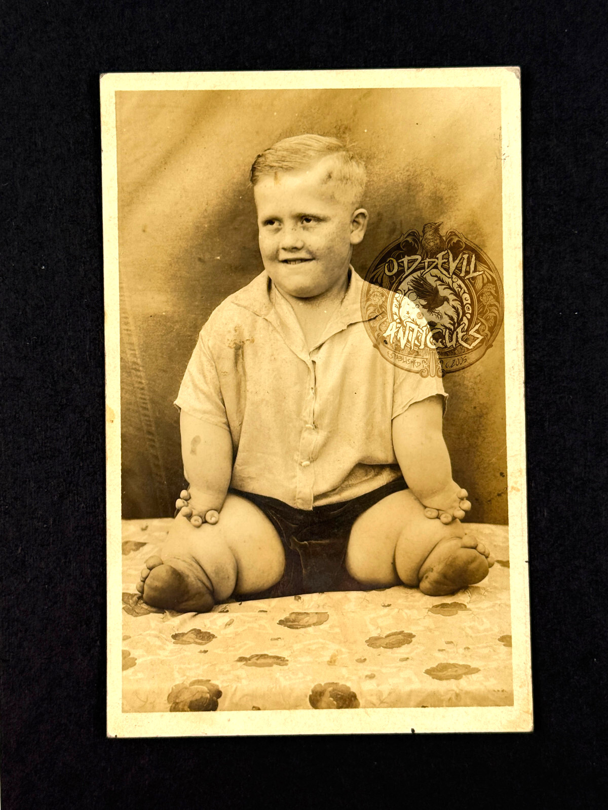 RARE 20s FREAK show Lobster Boy circus carnival sideshow postcard