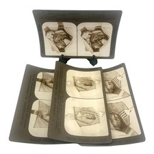 Antique 1908 Surgical Stereoview Cards | Appendectomy | Underwood & Underwood picture