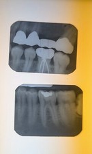 10 Dental X-ray Films, Vintage Curiosities & Oddities  picture