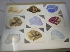  1950s French Neuropathology 15 Glass Slides – Brain Tissue Sections on Glass picture