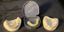 Three (3) Vintage Plaster Dental Molds TEETH Dentist Tooth Impressions ODDITIES picture
