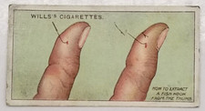 Wills's First Aid TO EXTRACT FISH-HOOK Medical Vintage Cigarette Card #49 picture