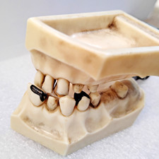 Vintage Columbia Dentoform Ivorine Dental w/ Gold Tooth & Other Metals picture