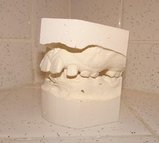 Vintage Irregular Teeth Impression plaster tooth casting dental oddity curiosity picture