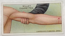Wills's First Aid COMPRESSION OF ARTERY Medical Vintage Cigarette Card #12 picture