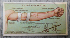 Wills's First Aid Cigarettes Tobacco Trade Card Vintage No. 11 Tourniquet picture
