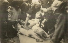 Doctor Attend to Child - Crowd Candid Action Amateur Real Photo Postcard c1910 picture