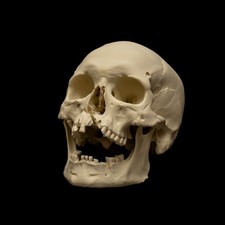 Replica Human Skull Life Size Medieval Warrior Battle of Visby Anatomical Model picture