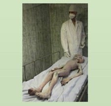 Vintage Creepy Alien Autopsy PHOTO Scary Weird X-Files Body Area 51 UFO Roswell picture