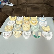 20 Dental Odd Plaster Real Tooth Teeth Molds Dentist Cast Impressions Vintage picture