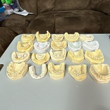 20 Dental Odd Plaster Real Tooth Teeth Molds Dentist Cast Impressions Vintage picture