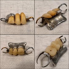 Antique 1800s Silver Partial Denture Porcelain Teeth Dental Medical Oddity picture